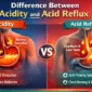 diff_between_acidity__acid_reflux2 85x85