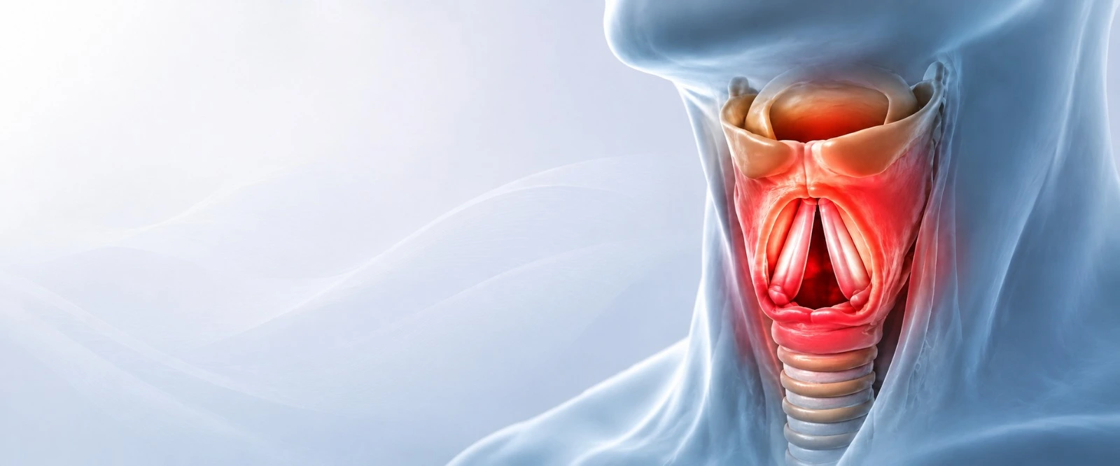 Medical diagram showing GERD with inflamed oesophagus causing hoarseness and throat irritation