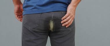 Constant pus discharge, a sign of an anal fistula